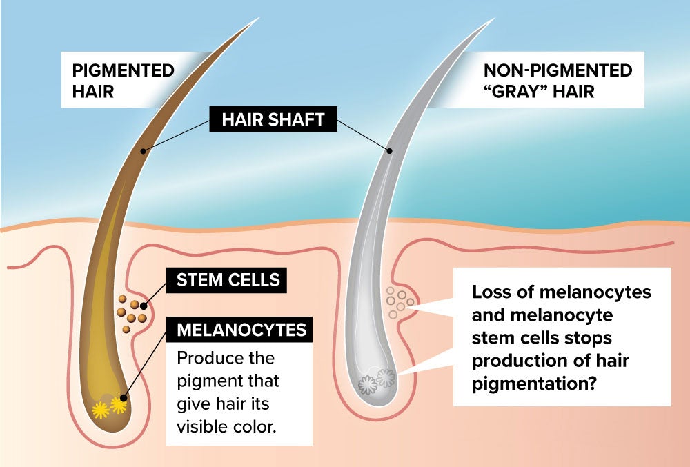 What Causes Grey Hair And How To Reverse It